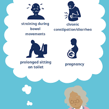 causes of hemorrhoids